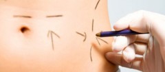 cirurgia-plastica-jacarezinho-1350682108